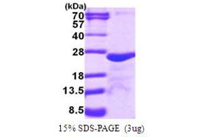 SDS-PAGE (SDS) image for Myosin, Light Chain 5, Regulatory (MYL5) (AA 1-173) protein (His tag) (ABIN667957) (MYL5 Protein (AA 1-173) (His tag))