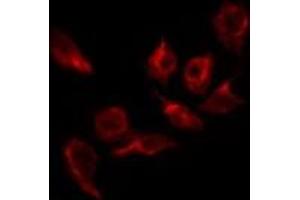 ABIN6269282 staining 293 by IF/ICC. (EFNB1/2 antibody)