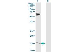 Western Blot analysis of MB expression in transfected 293T cell line by MB MaxPab polyclonal antibody. (Myoglobin antibody  (AA 1-154))
