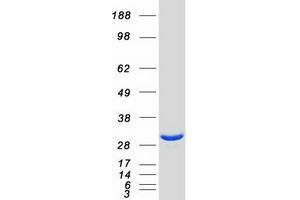 Western Blotting (WB) image for Platelet-Activating Factor Acetylhydrolase 1b, Catalytic Subunit 2 (30kDa) (PAFAH1B2) protein (Myc-DYKDDDDK Tag) (ABIN2728139)