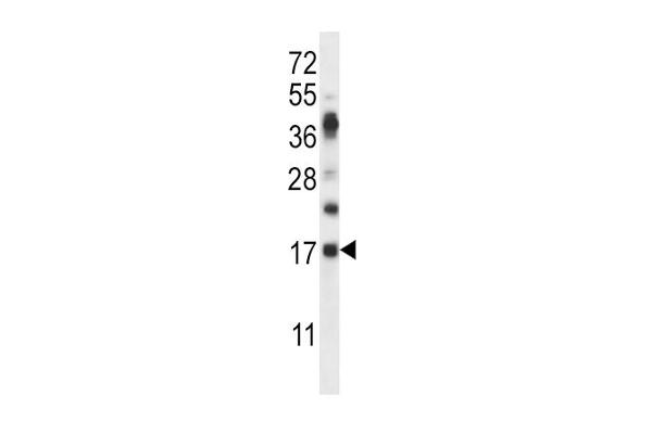 RNASE6 Antikörper  (C-Term)
