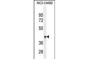 FX4L1 Antibody (N-term) (ABIN655284 and ABIN2844875) western blot analysis in NCI- cell line lysates (35 μg/lane). (FOXD4L1 antibody  (N-Term))
