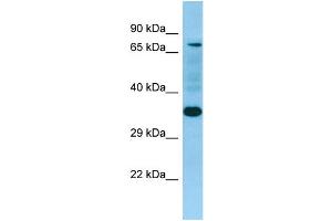 WB Suggested Anti-SELPLG Antibody Titration: 1. (SELPLG antibody  (N-Term))