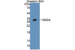 Western Blotting (WB) image for anti-ATP-Binding Cassette, Sub-Family F (GCN20), Member 2 (ABCF2) (AA 396-623) antibody (ABIN5013201)