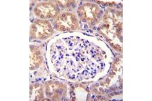 Formalin fixed, paraffin embedded human kidney tissue stained with SLCO4C1 / OATP4C1 Antibody (C-term) followed by peroxidase conjugation of the secondary antibody and DAB staining. (SLCO4C1 antibody  (C-Term))