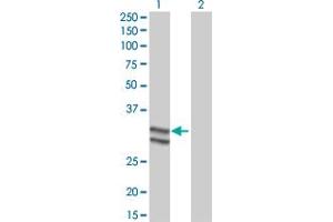 Western Blot analysis of SERPINC1 expression in transfected 293T cell line by SERPINC1 monoclonal antibody (M02), clone 2B12. (SERPINC1 antibody  (AA 1-259))