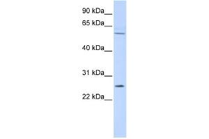 WB Suggested Anti-FAM124A Antibody Titration: 0. (FAM124A antibody  (Middle Region))