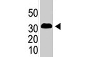 The SNAI1 polyclonal antibody  is used in Western blot to detect SNAI1 in SNAI1-293 cells (flag-tagged) . (SNAIL antibody  (AA 9-39))