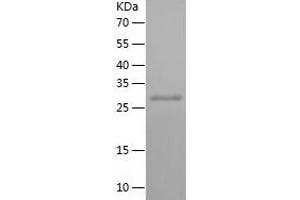 Western Blotting (WB) image for Zinc Finger Protein 337 (ZNF337) (AA 189-451) protein (His tag) (ABIN7125786)