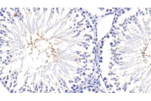 Detection of TNFa in Rat Testis Tissue using Polyclonal Antibody to Tumor Necrosis Factor Alpha (TNFa) (TNF alpha antibody  (AA 80-235))