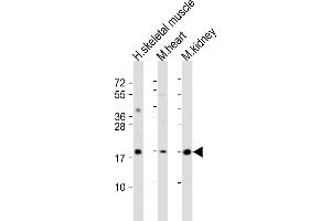 All lanes : Anti-SDHC Antibody (C-Term) at 1:2000 dilution Lane 1: human skeletal muscle lysate Lane 2: mouse heart lysate Lane 3: mouse kidney lysate Lysates/proteins at 20 μg per lane. (SDHC antibody  (AA 113-144))