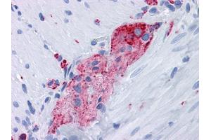 Immunohistochemical analysis of paraffin-embedded human Small Intestine, myenteric plexus tissues using anti-SYP mouse mAb (Synaptophysin antibody)