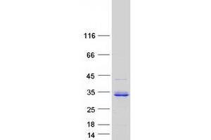 Validation with Western Blot