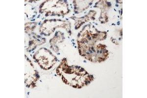 Immunohistochemical analysis of Factor XII HC staining in human kidney formalin fixed paraffin embedded tissue section. (F12 antibody  (Heavy Chain, N-Term))