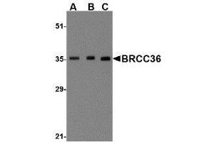 Western blot analysis of BRCC36 in MCF7 cell lysate with AP30164PU-N BRCC36 antibody at (A) 0.