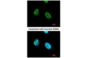 ICC/IF Image Immunofluorescence analysis of paraformaldehyde-fixed HeLa, using ATF7, antibody at 1:500 dilution. (ATF7 antibody  (C-Term))