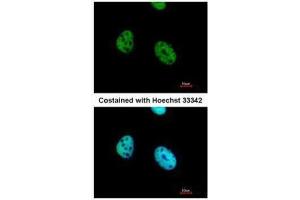 ICC/IF Image Immunofluorescence analysis of paraformaldehyde-fixed HeLa, using ATF7, antibody at 1:500 dilution. (AFT7 antibody  (C-Term))