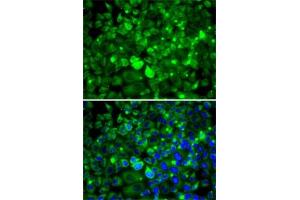 Immunofluorescence analysis of MCF7 cells using RPLP1 antibody (ABIN6129657, ABIN6147166, ABIN6147167 and ABIN6222445). (RPLP1 antibody  (AA 1-114))