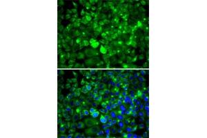 Immunofluorescence analysis of MCF7 cells using RPLP1 antibody (ABIN6129657, ABIN6147166, ABIN6147167 and ABIN6222445).