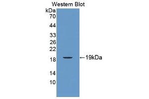 Figure. (CD160 antibody  (AA 33-171))