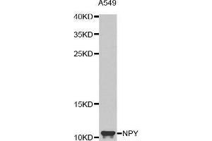 Western blot analysis of extracts of A549 cell line, using NPY antibody.
