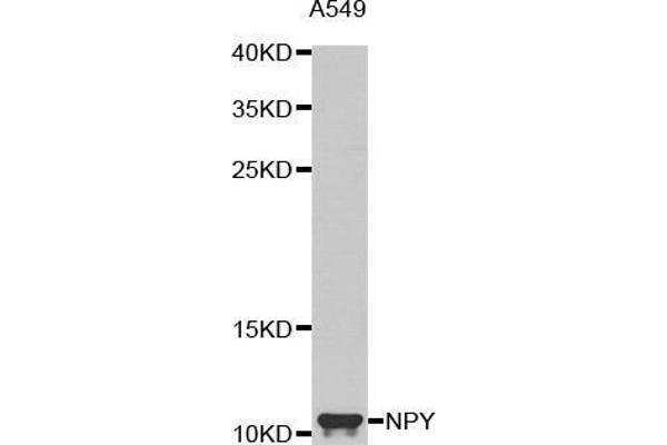 NPY anticorps  (AA 1-97)