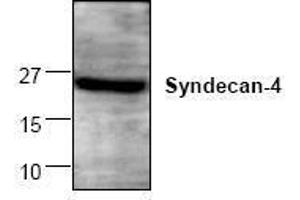 Image no. 1 for anti-Syndecan 4 (SDC4) antibody (ABIN127275) (SDC4 antibody)
