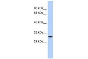 Image no. 1 for anti-DIRAS Family, GTP-Binding RAS-Like 1 (DIRAS1) (C-Term) antibody (ABIN6743669) (DIRAS1 antibody  (C-Term))