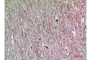 Immunohistochemistry (IHC) analysis of paraffin-embedded Human Brain, antibody was diluted at 1:200. (ADAMTS18 antibody)