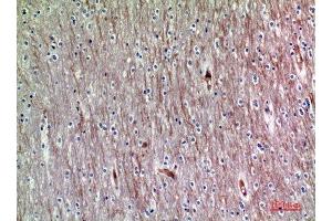Immunohistochemistry (IHC) analysis of paraffin-embedded Human Brain, antibody was diluted at 1:200.
