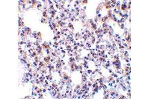 Immunohistochemistry of BCAP31 in rat lung tissue with BCAP31 polyclonal antibody  at 10 ug/mL .
