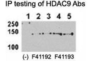 HDAC9 antibody NSJ# F41192 and NSJ# F41193 can both immunoprecipitate the protein from HeLa-HDAC9 tranfected cells. (HDAC9 antibody  (AA 2-32))