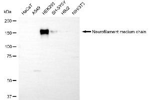Western blotting analysis using neurofilament medium chain antibody (ABIN7800956).