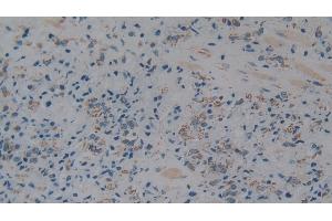 Immunohistochemistry (IHC) image for anti-Complement Component 1, Q Subcomponent Binding Protein (C1QBP) (AA 76-282) antibody (ABIN7432316)