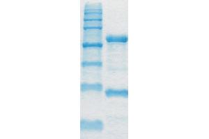Image no. 1 for anti-Toxin B antibody (ABIN335173) (Toxin B antibody)