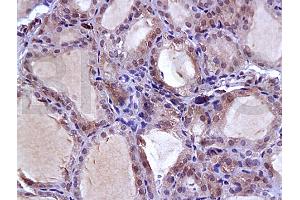 Formalin-fixed and paraffin embedded rat thyroid gland labeled with Anti-NIS Polyclonal Antibody, Unconjugated (ABIN668751) at 1:200, followed by conjugation to the secondary antibody and DAB staining (SLC5A5 antibody  (AA 525-618))