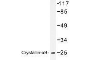 Western blot analysis of Crystallin-αB antibody in extracts from mouse lung cells. (CRYAB antibody)