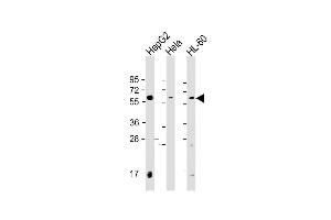 Western Blot at 1:2000 dilution Lane 1: HepG2 whole cell lysate Lane 2: Hela whole cell lysate Lane 3: HL-60 whole cell lysate Lysates/proteins at 20 ug per lane. (PI4K2A antibody  (C-Term))