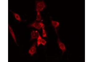 ABIN6275145 staining COLO205 cells by IF/ICC. (GCP6 antibody  (Internal Region))