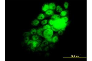 Immunofluorescence of monoclonal antibody to RBM9 on A-431 cell. (RBM9 antibody  (AA 1-100))