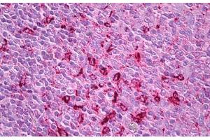 Anti-Cathepsin S antibody IHC staining of human tonsil. (Cathepsin S antibody)