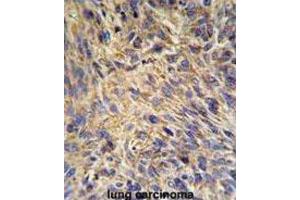 Immunohistochemistry (IHC) image for anti-Heat Shock Protein 90kDa beta (Grp94), Member 1 (HSP90B1) antibody (ABIN3002162)