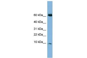 WB Suggested Anti-CRIP1 Antibody Titration:  0.