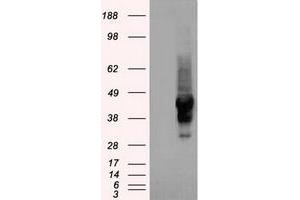 Image no. 1 for anti-serpin Peptidase Inhibitor, Clade A (Alpha-1 Antiproteinase, Antitrypsin), Member 1 (SERPINA1) (AA 26-418) antibody (ABIN1491294) (SERPINA1 antibody  (AA 26-418))