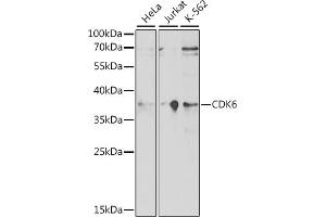 Western blot analysis of extracts of various cell lines, using CDK6 antibody (ABIN7266595) at 1:1000 dilution.