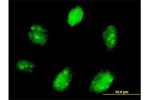 Immunofluorescence of purified MaxPab antibody to ETV7 on Daoy cell. (ETV7 antibody  (AA 1-341))