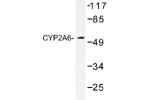 Image no. 1 for anti-Cytochrome P450, Family 2, Subfamily A, Polypeptide 6 (CYP2A6) antibody (ABIN272273) (CYP2A6 antibody)