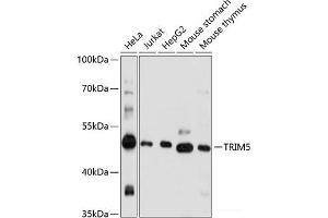 Western blot analysis of extracts of various cell lines using TRIM5 Polyclonal Antibody at dilution of 1:1000. (TRIM5 antibody)