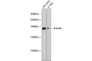 Western blot analysis of extracts of various cell lines, using Kdm6b antibody (ABIN6131823, ABIN6142806, ABIN6142809 and ABIN6216507) at 1:3000 dilution. (Kdm6b antibody  (AA 265-450))
