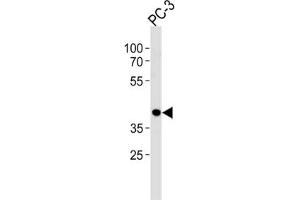 Western Blotting (WB) image for anti-CAMP Responsive Element Binding Protein 3-Like 4 (CREB3L4) antibody (ABIN2998939)